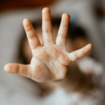 Child erroneously given HIV treatment battles brain damage