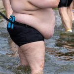 How nutrition, mental health and food choices fuel South Africa’s obesity crisis