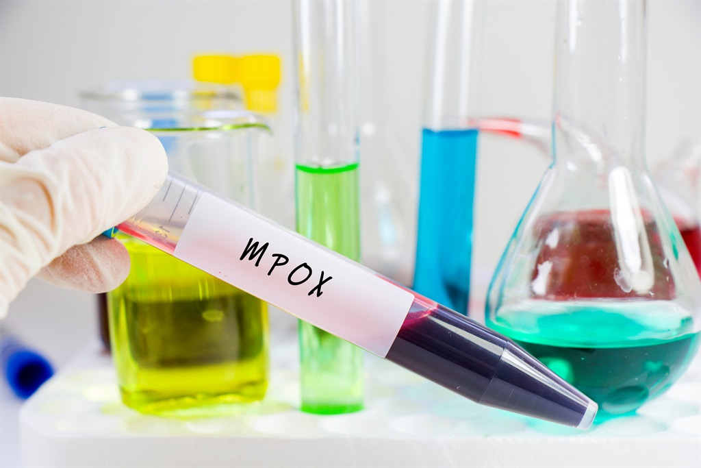 News24 | ‘Racist’ monkeypox name still holding back fight in French, Spanish and Portuguese, academic say