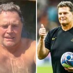 Ouch! Rassie reveals painful shoulder scar [video]