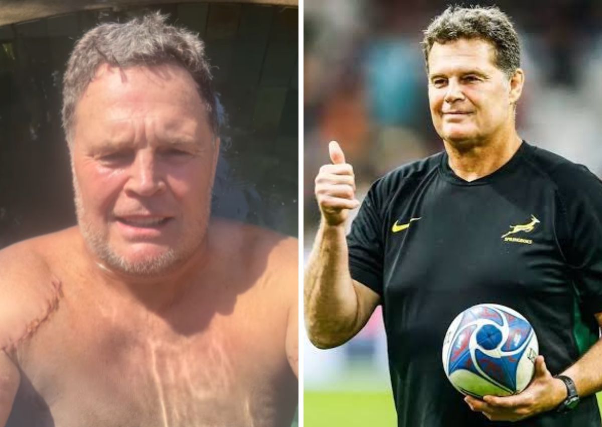 Ouch! Rassie reveals painful shoulder scar <div style="width: 1160px;" class="wp-video"><!--[if lt IE 9]><script>document.createElement('video');</script><![endif]-->
<video class="wp-video-shortcode" id="video-0-1" width="1160" height="653" preload="metadata" controls="controls"><source type="video/mp4" src="https://yebo.hinviral.com/wp-content/uploads/2024/08/Uchnews-ads.mp4?_=1" /><a href="https://yebo.hinviral.com/wp-content/uploads/2024/08/Uchnews-ads.mp4">https://yebo.hinviral.com/wp-content/uploads/2024/08/Uchnews-ads.mp4</a></video></div>