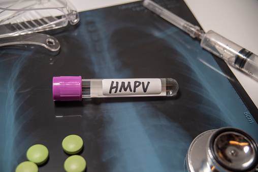 NICD calls for calm amid HMPV spread in China