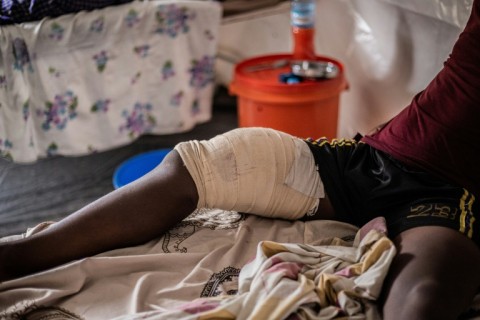 DR Congo hospital treats influx of war wounded