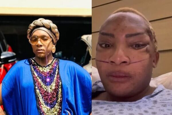 Gogo Manzini recovers in Turkey after several plastic surgeries