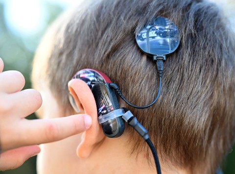 Cochlear Implant Day | Listening to the plight of hearing impaired