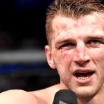 Dan Hooker posts graphic video of hand cast being removed